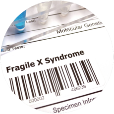 Fragile X Fragile X